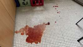 Blutiger Durchfall-Beitrag-Bild