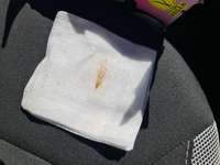 Hat jemand Erfahrungen mit Grannen ? und wie könnte man dem wenn möglich vorbeugen ?-Beitrag-Bild