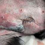 Verhalten nach OP-Beitrag-Bild