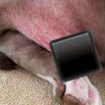 Ausschlag / allergische Reaktion-Beitrag-Bild