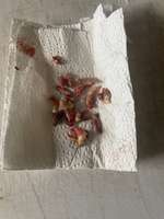 14 Zähne gezogen-Beitrag-Bild