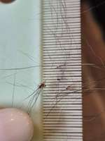 Sind das Schuppen oder Parasiten?-Beitrag-Bild