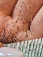 Sind das Schuppen oder Parasiten?-Beitrag-Bild