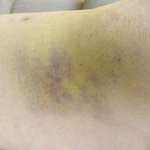 Welche Verletzungen habt ihr durch euren Hund erlitten?-Beitrag-Bild