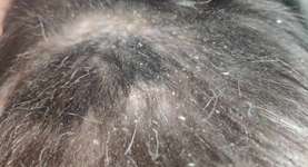 Erfahrungsberichte Cushing Syndrom beim Hund-Beitrag-Bild