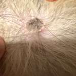 Hautveränderung entdeckt-Beitrag-Bild