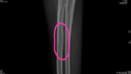 Hund humpelt-Beitrag-Bild