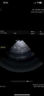 Trächtigkeit oder doch nicht?-Beitrag-Bild