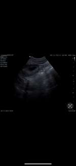 Nierenprobleme?-Beitrag-Bild