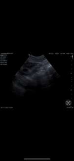 Nierenprobleme?-Beitrag-Bild