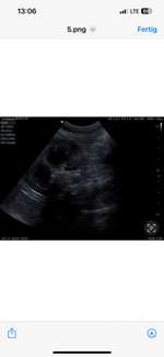 Nierenprobleme?-Beitrag-Bild