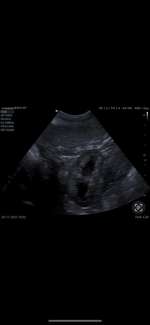 Nierenprobleme?-Beitrag-Bild