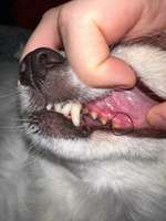 Zahnfleischverfärbung-Beitrag-Bild