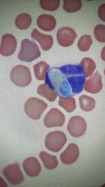 Hepatozoonose-Beitrag-Bild