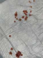 Blutungen..-Beitrag-Bild