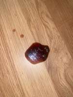 Blutungen..-Beitrag-Bild