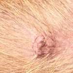 Hautveränderung entdeckt-Beitrag-Bild