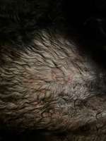 Pickel und offene Stellen.-Beitrag-Bild