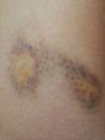 Angsthunde-Beitrag-Bild