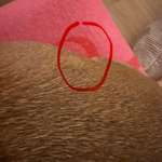 Beule am Rippenbogen-Beitrag-Bild