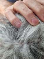 Gesundheit, parasiten-Beitrag-Bild