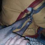 Stracke/steife Ärmchen beim Schmusen-Beitrag-Bild