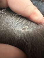 Komisches Ding aus der Haut ???-Beitrag-Bild