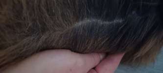 Schuppen oder Floheier?-Beitrag-Bild