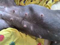 Ausschlag? Allergie? Was könnte das sein.?-Beitrag-Bild