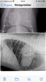 Ich hätte gerne eine Auskunft über die Röntgenbilder von Ihnen Was sehen Sie darauf Es ist wichtig-Beitrag-Bild