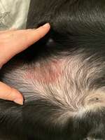 Ausschlag-Beitrag-Bild