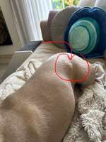 Bluterguss?-Beitrag-Bild