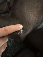 Weiße haarlose schuppige Stelle oberhalb des linken vorderen Ellenbogens-Beitrag-Bild