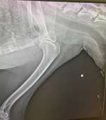 Schulterschmerzen? - Lösungsansätze gesucht!-Beitrag-Bild