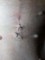 Kastrationsnarbe Hündin-Beitrag-Bild