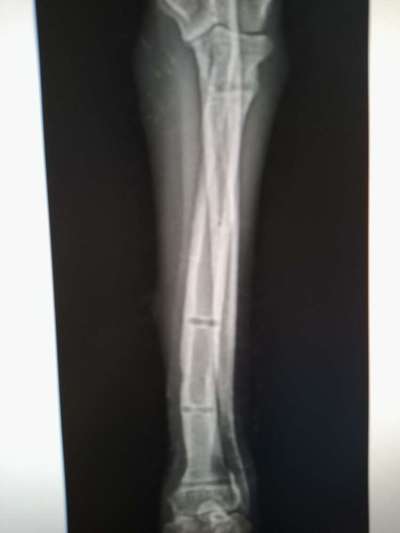 Fixateur extern - wie geht man damit um?-Beitrag-Bild