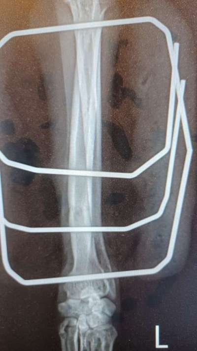 Fixateur extern - wie geht man damit um?-Beitrag-Bild