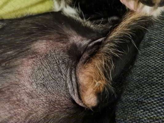 Kreisrundes Erythem,Borrelliose?-Beitrag-Bild