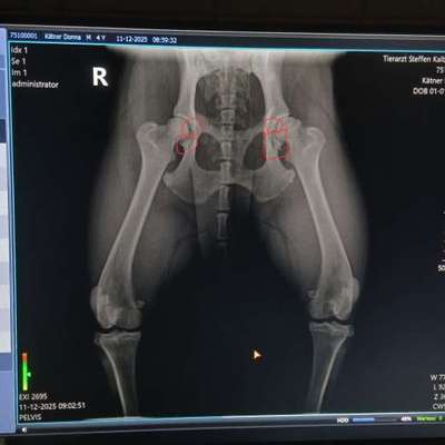 Arthrose?-Beitrag-Bild