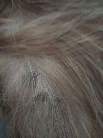 Hautkrebs oder Muttermal?-Beitrag-Bild