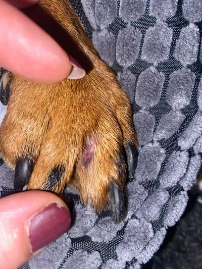 Entzündung/Abzess zwischen den Zehen-Beitrag-Bild