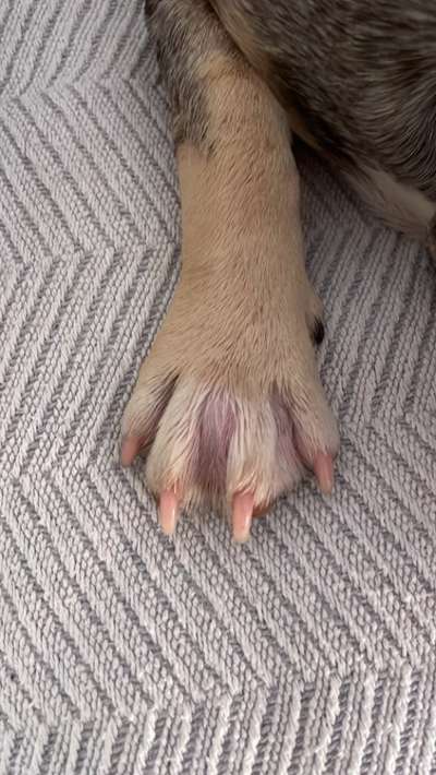 Entzündung/Abzess zwischen den Zehen-Beitrag-Bild