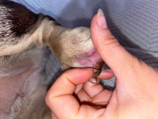 Entzündung/Abzess zwischen den Zehen-Beitrag-Bild