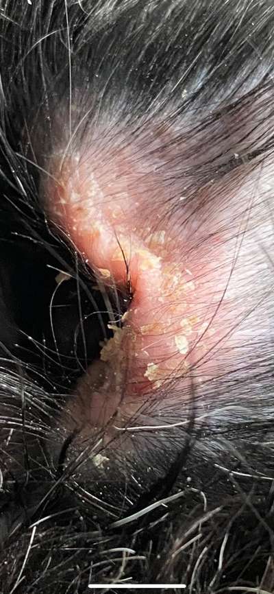 Sebadenitis-Beitrag-Bild