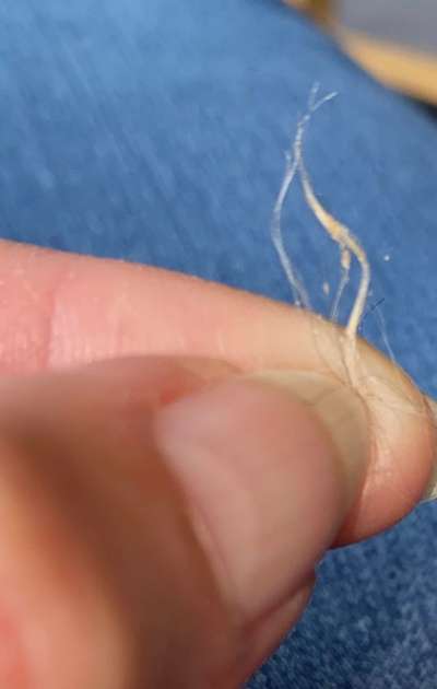 Sebadenitis-Beitrag-Bild