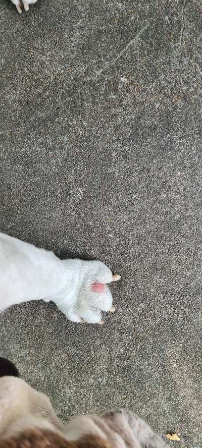 Entzündung/Abzess zwischen den Zehen-Beitrag-Bild