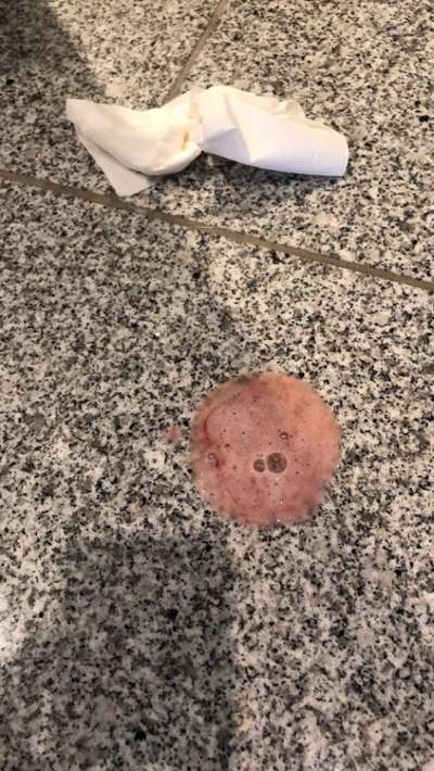 Mandelentzündung oder doch etwas anderes?-Beitrag-Bild