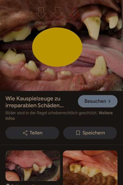 Graue Zahnverfärbung-Beitrag-Bild