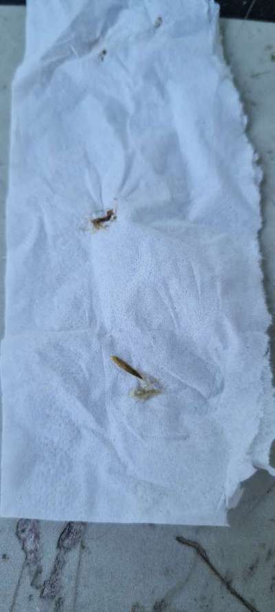 Augen Ausfluss-Beitrag-Bild