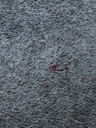 Durchfall-Beitrag-Bild